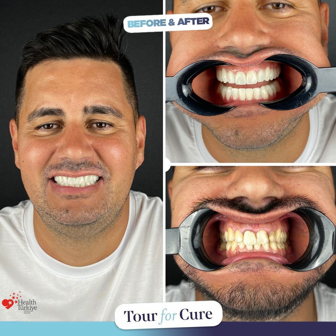 Beautiful teeth, beautiful smiles! We’re excited to share our patient’s incredib