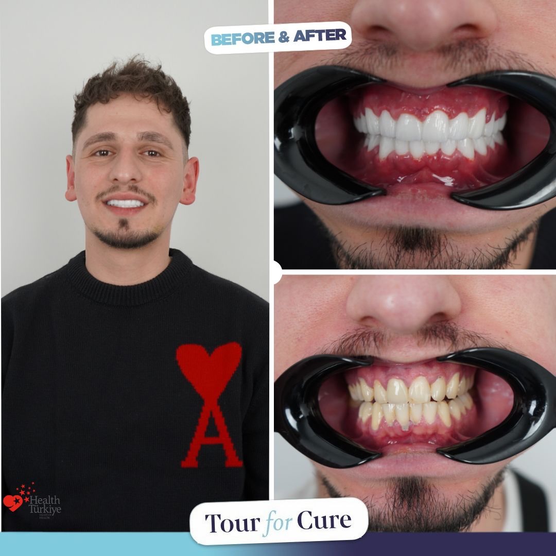 What can a smile change? 😁💪💎
With Tour For Cure expert team, achieving your drea