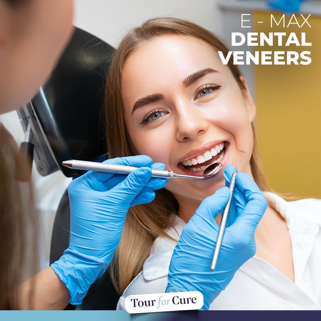 E-max veneers are high-quality porcelain shells applied to the front surface of 