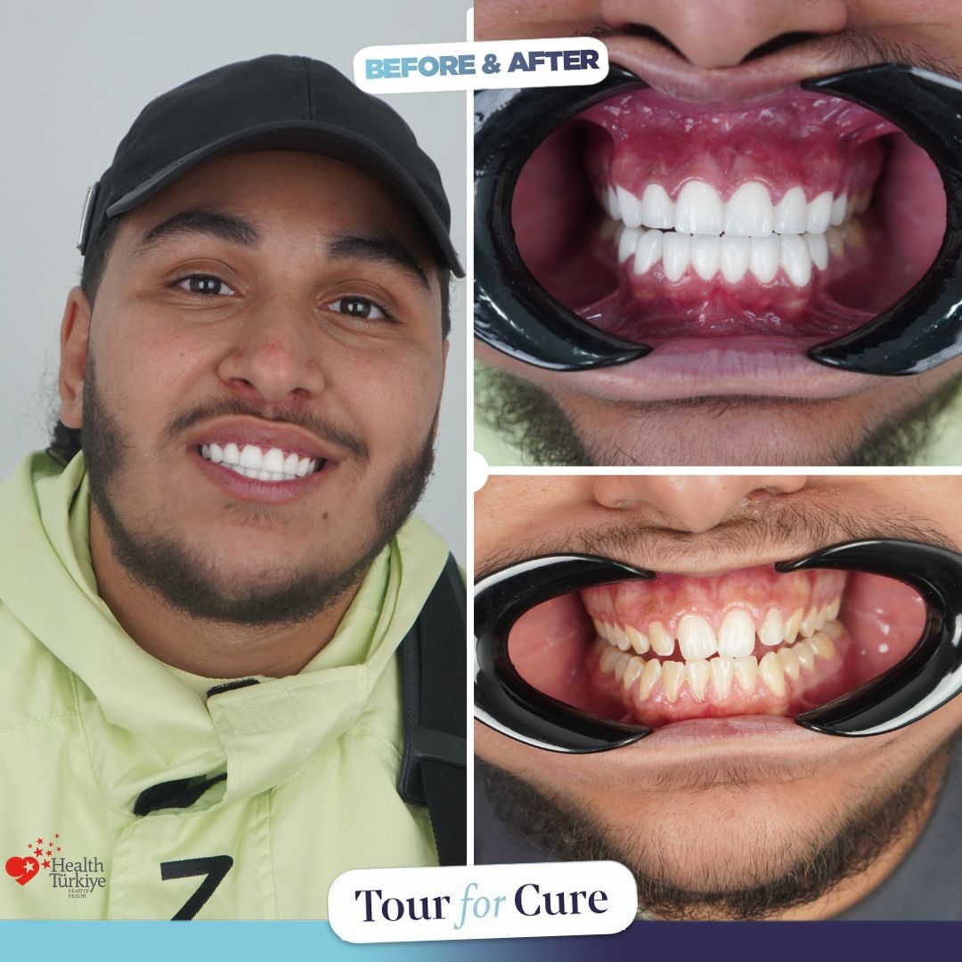 A smile…
Sometimes it means more than aesthetics.
It means confidence.

As Tour 