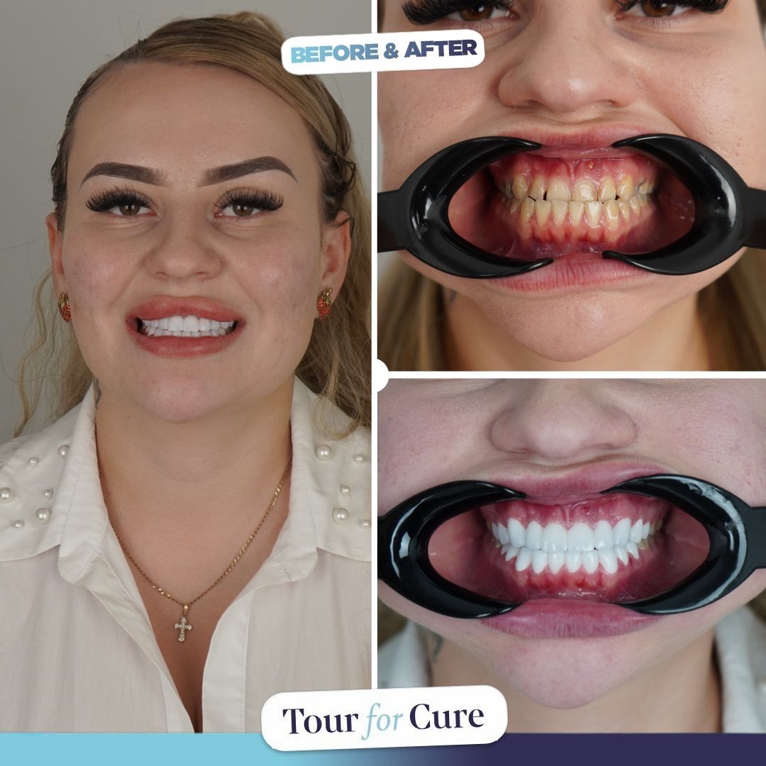 Meet our new smile story! We’re excited to share the incredible transformation o