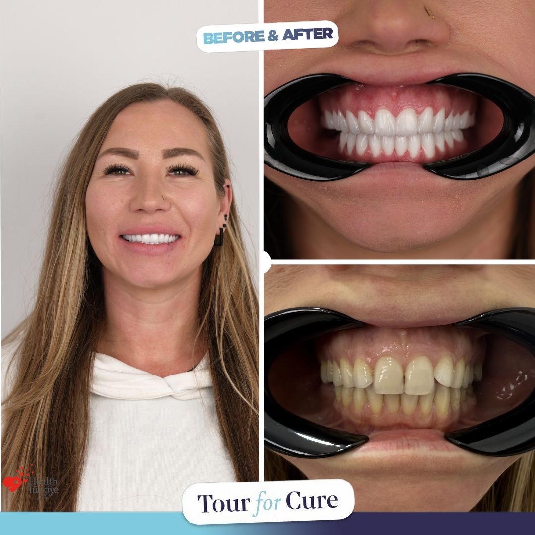 ✨Transformation begins♻️ with Tour For Cure! Now smiles are healthier, brighter,