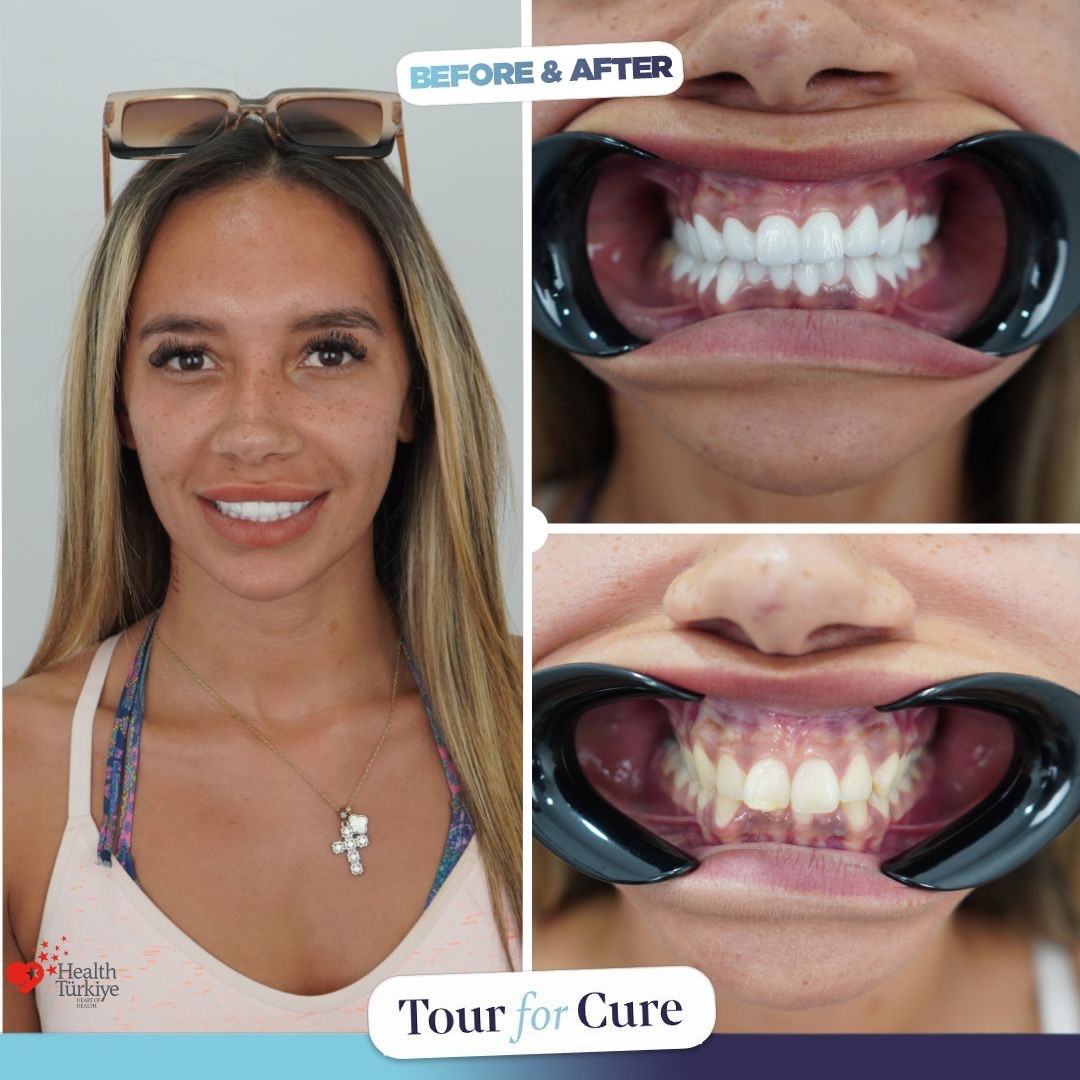 For brilliantly shining teeth, choose Tour For Cure.

📞+90 546 110 10 90
🌐 https