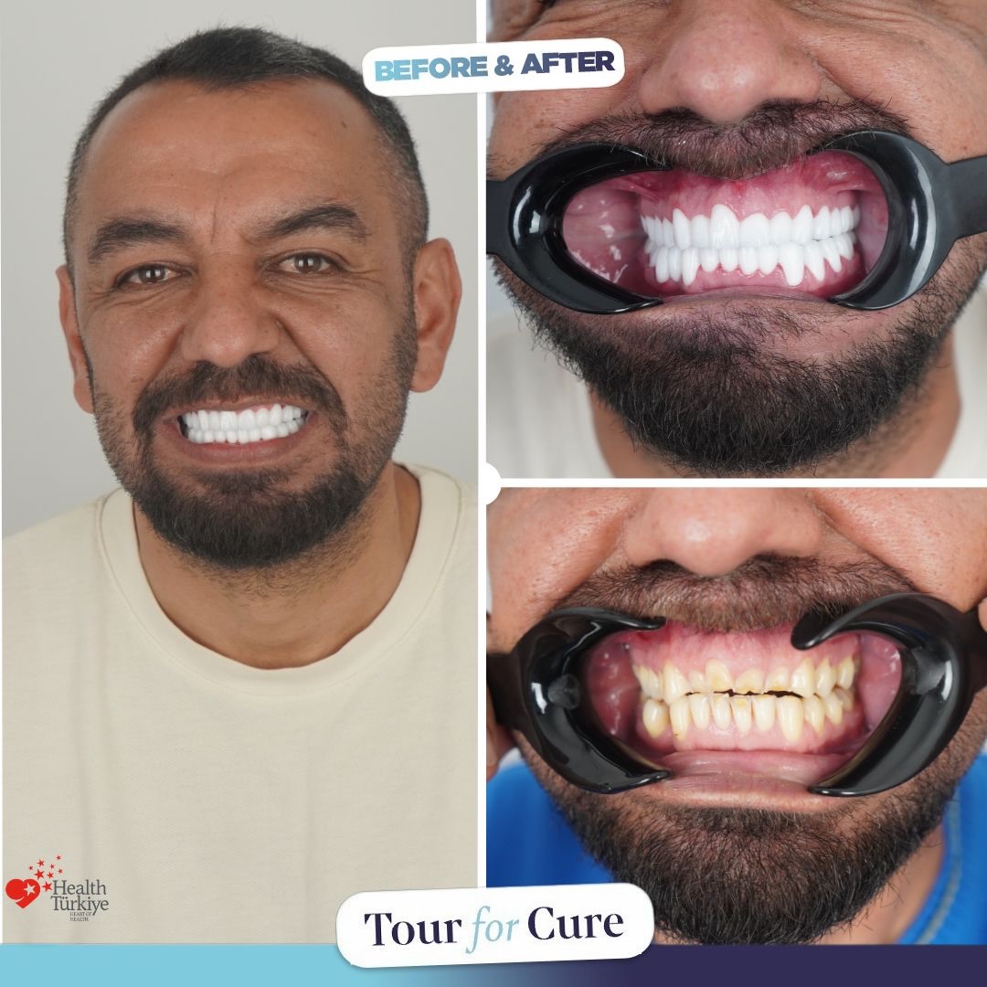 😁😁A perfect smile is crafted by expert hands. Achieve your perfect smile with To