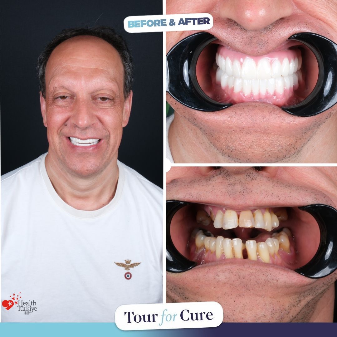 Together we achieve a healthy beautiful smile 🤩 We are always with you with reli
