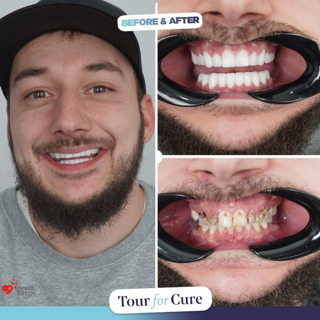 😁😁A perfect smile is crafted by expert hands. Achieve your perfect smile with To