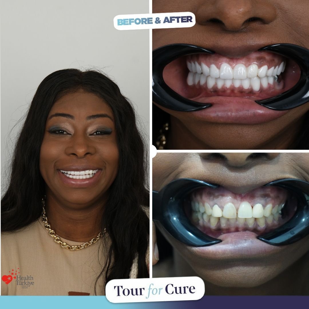 Meet our new smile story! We’re excited to share the incredible transformation o