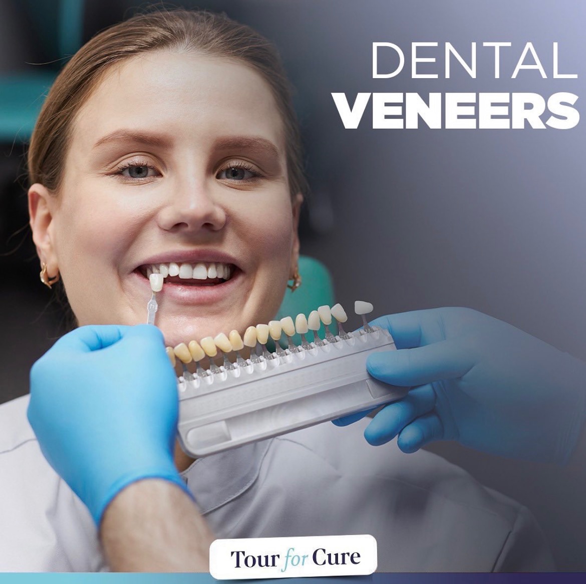 Dental Veneers or laminate veneers are covers that you can have them put on the 