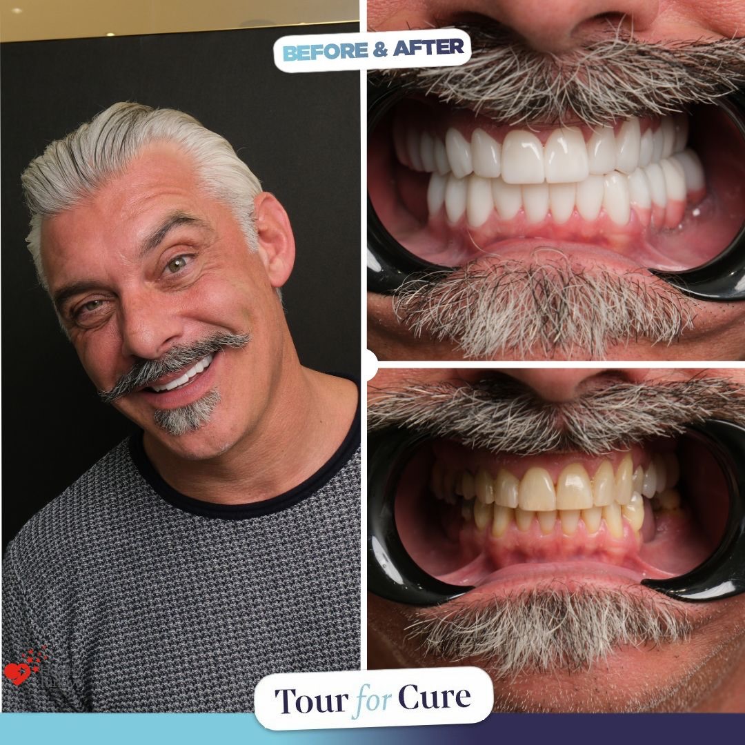 😁😁A perfect smile is crafted by expert hands. Achieve your perfect smile with To